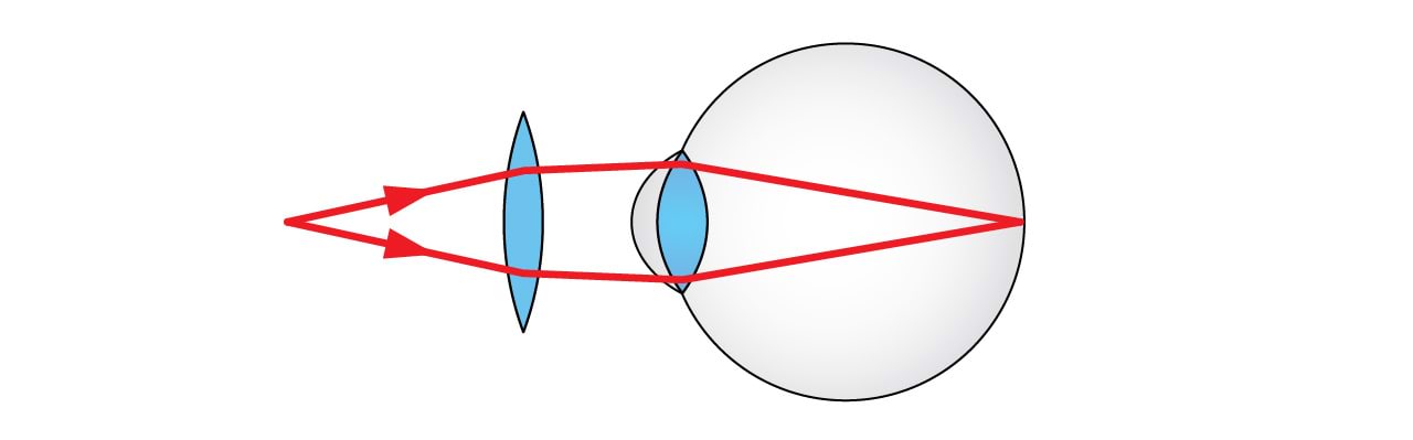 Correction for distance vision