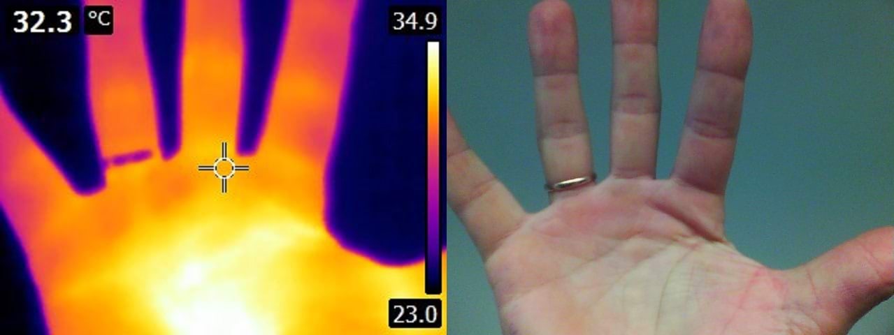 Hand and ring in infrared camera