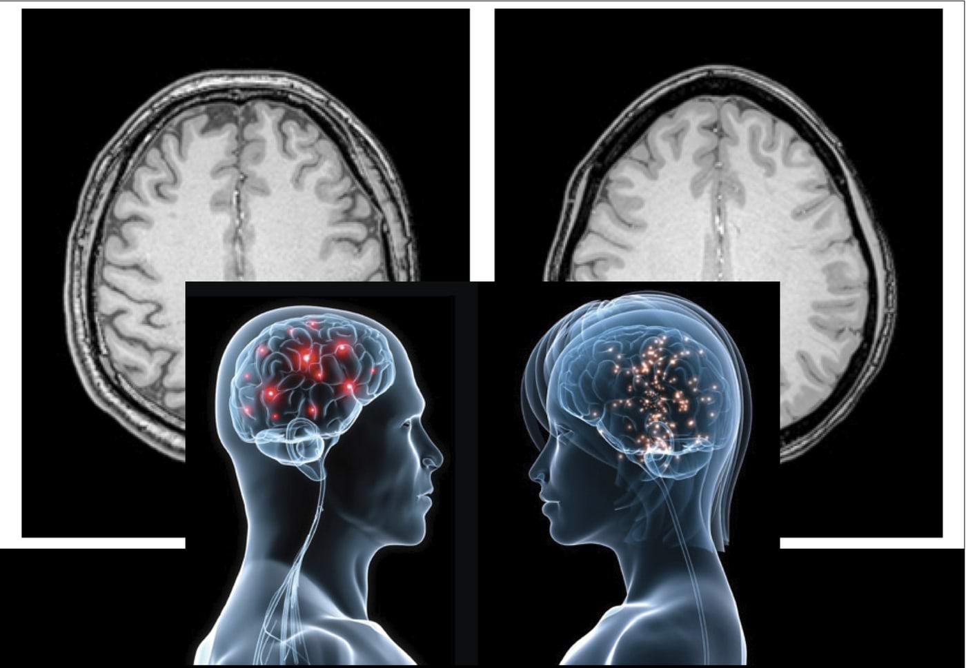 Neuroimaging, mis toimub inimese ajus?